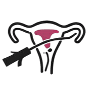 Υστεροσκόπηση