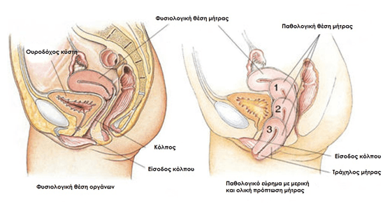 Ουρογυναικολογική Χειρουργική
